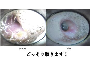 イヤーフレスカ 三鷹/耳つぼマッサージ