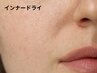 【肌悩み徹底相談】フェイシャルスペシャルコース　　７0分 ¥6,800