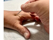 村田治療院の雰囲気(鍼が不安な方♪フォトギャラリー、ブログご覧下さい!)