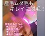 【女性】お顔脱毛★コラーゲン生成する美肌脱毛(幹細胞パック付)...6800円