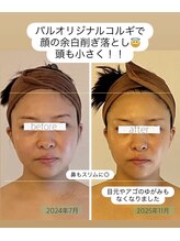 パル コルギサロン(Pal. Korugi salon)/コルギビフォーアフター