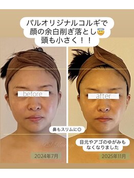 パル コルギサロン(Pal. Korugi salon)/コルギビフォーアフター