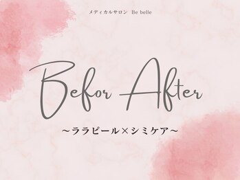 ビベル 八木店(Bebelle)/ビフォーアフター