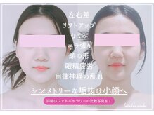 トゥインクル 麻布(twinkle)