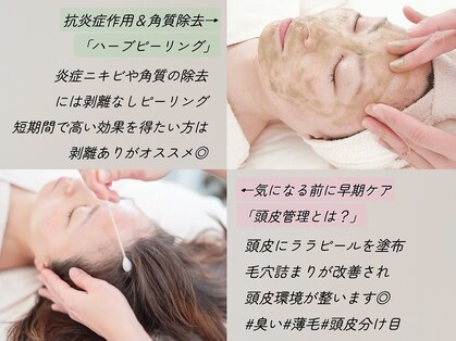 チップ(chip)の写真