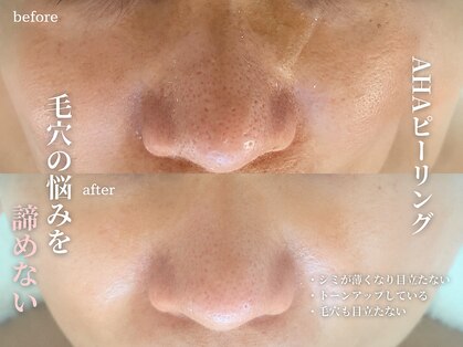 エーサロン(A-Salon)の写真
