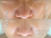 エーサロン(A-Salon)