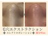 【2回目以降のご来店】毛穴詰まり取り放題+マシーン+部分Wax脱毛¥23000