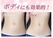 リフト センター南(Lift)