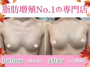 サラエクセレント 銀座の写真/秋冬のおしゃれ＆仮装に！今から始めるバストケア「イベント直前」ではなく今から始めるのがおすすめです★
