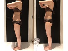 リボディ 表参道(An re Body)/before→after