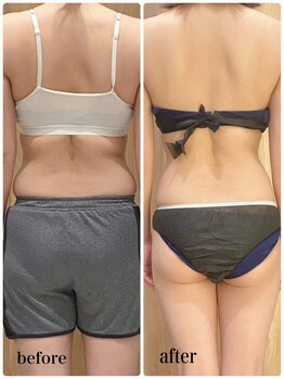 ベベクロスディディア 野々市市役所前店(Bebe×DiDiA)/3か月 before→after 背中