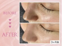 クリアラボ 川崎(Clear Lab)/韓国肌管理&毛穴洗浄専門店