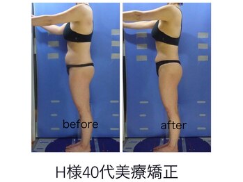 エステージ(estage)/