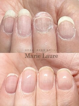 マリーロール 梅田店(Marie Laure)/自爪育成/深爪矯正/ネイルケア