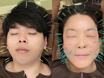 谷町さくら鍼灸院の写真/【鍼灸師の資格を持った経験豊富なオーナーがお悩みを解決】8時~23時までお仕事前後なども大歓迎☆[天満橋]