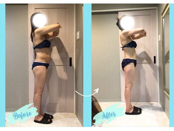 千歳の女神 西尾本店/【施術風景】Before/After