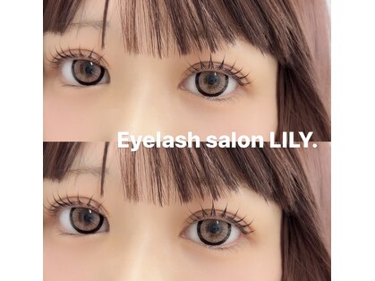 リリー(LILY.)の写真
