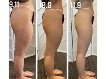 サロン ヌーク(salon Nook)の雰囲気（痩身ケア）