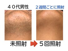 メンズ脱毛サロン エビアス 旭川豊岡(evias)の雰囲気（1回の所要時間は僅か10～15分♪ 夜21時まで営業！お仕事帰りに◎）