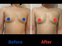 ポインセチア(Poinsettia)/ダイナミックバスト4DX/並び比較