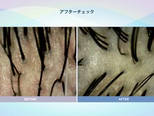 アンス(anth:)/お客様の仕上がり