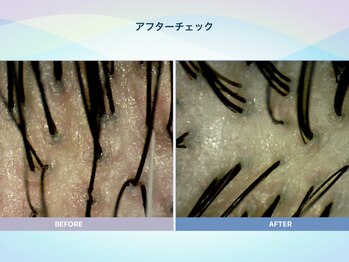 アンス(anth:)/お客様の仕上がり