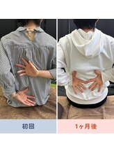ナゴミ鍼灸 整体院(NAGOMI鍼灸 整体院)/左肩の痛みと可動域