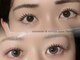 ローワン(Rowan)の写真