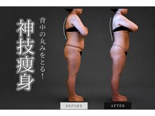 ボーテヌール(Beaute Nheur)/美骨