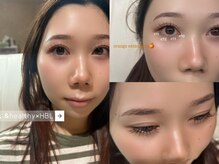 ウェヌス アイ ビューティ(VENUS eye beauty)/＆healthy