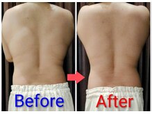 坂井整体院/脂肪分解酵素ジェル全身1回