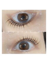 プリュスマイル(+Smile.)/アップワードリフト