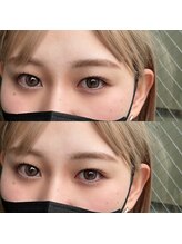 エニュ(anew)/上下Lashlift