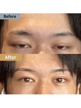 眉毛ハウス 吉祥寺店(眉毛HOUSE)/お客様の施術例(吉祥寺/東京)