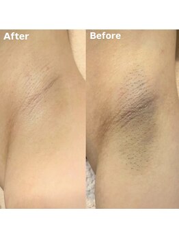 ラティア(Ratia)/