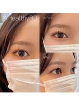 エル 薬院店(Eru)/アンドヘルシー80本