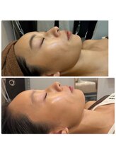 スリーズララ(Cerise LaLa)/