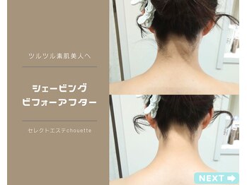セレクトエステ シュエット(chouette)/本格シェービング
