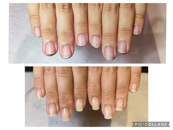 アンドネイル 海老名(&nail)/Before After