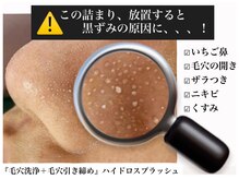 詰まった毛穴もスッキリ◎施術後は取れた角栓が目に見てわかる！