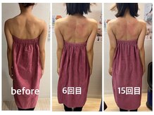 ロココ 豊田店(Rococo)/ビフォーアフター