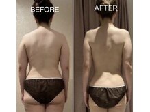 フーシー(FooSee)の雰囲気（インドエステ痩身で骨格くっきり！ブライダルにもおすすめです。）