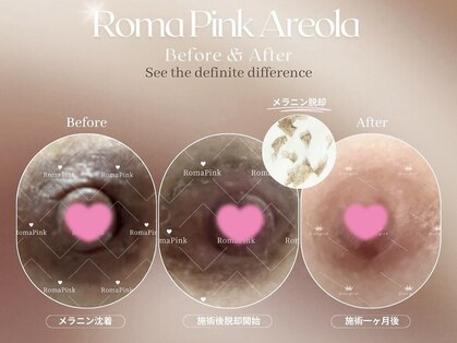 ヴァーチュ(Virtue)の写真