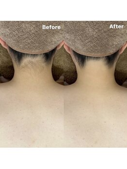 ラティア(Ratia)/