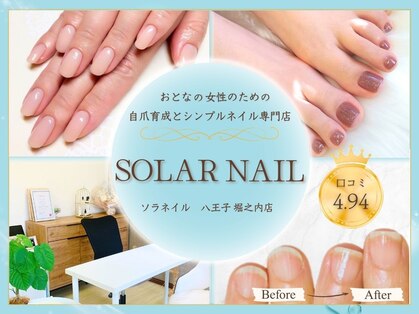 ソラネイル(SOLAR NAIL)の写真