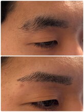 スリーピース(3Peace)/Before/After