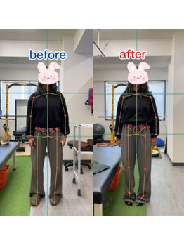 サンシー整体(SunCY整体)/30代女性