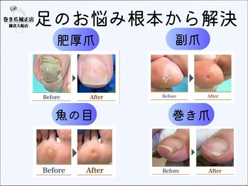 巻き爪補正店 鎌倉大船店の写真/足のお悩みを豊富な経験と技術で改善いたします◎プライべ―ト空間でコンプレックスも相談しやすい♪