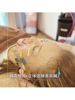 うぃず鍼灸整骨院/【施術例１０】